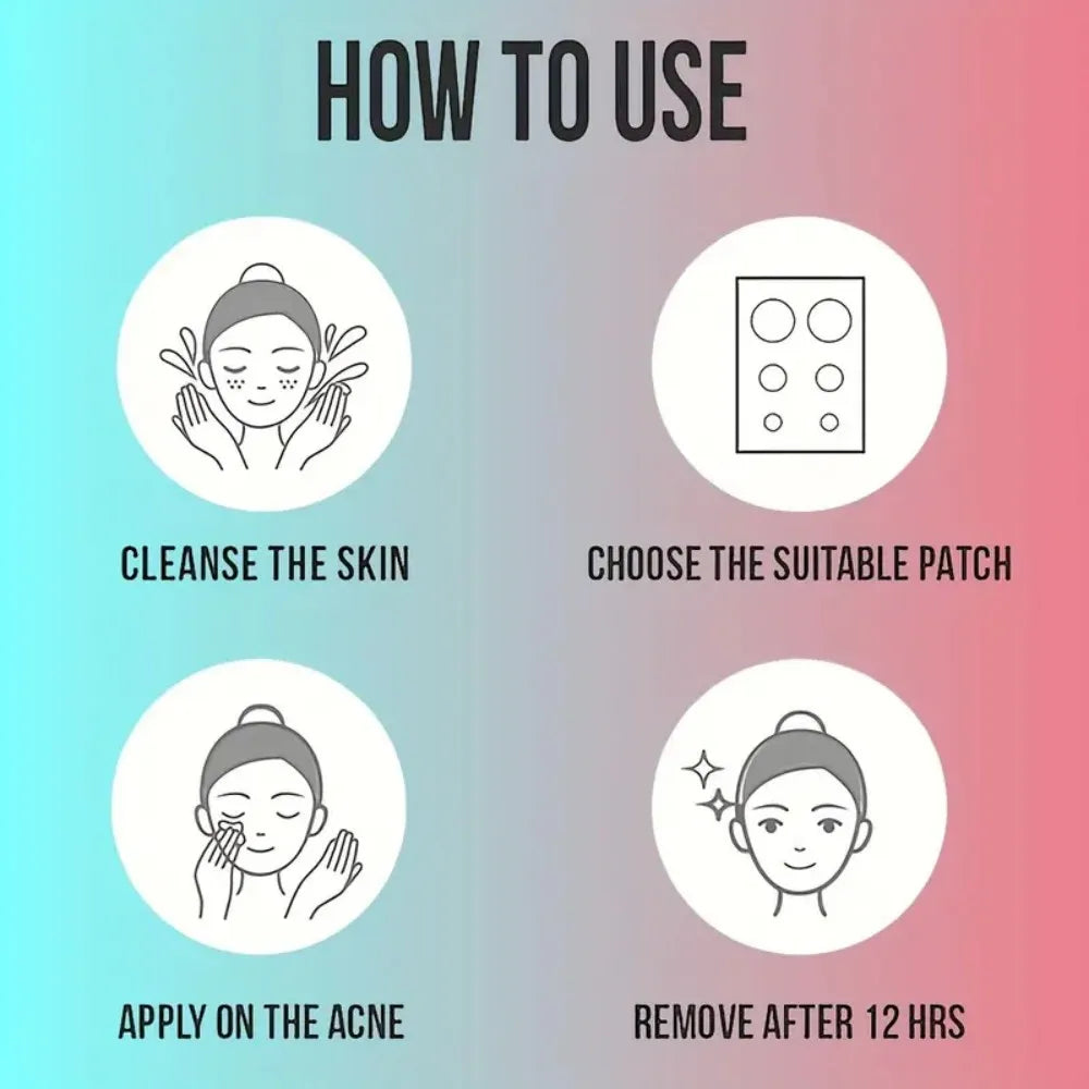 80/160pcs Star Acne Patch Set – Various Sizes, Alcohol-Free, Gentle Deep-Cleansing, Invisible & Safe for Sensitive Skin
